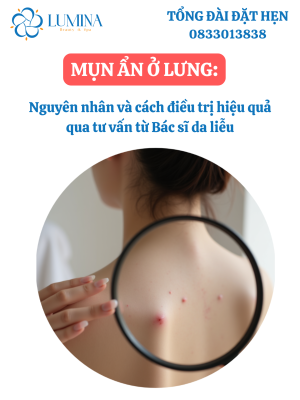 MỤN ẨN Ở LƯNG