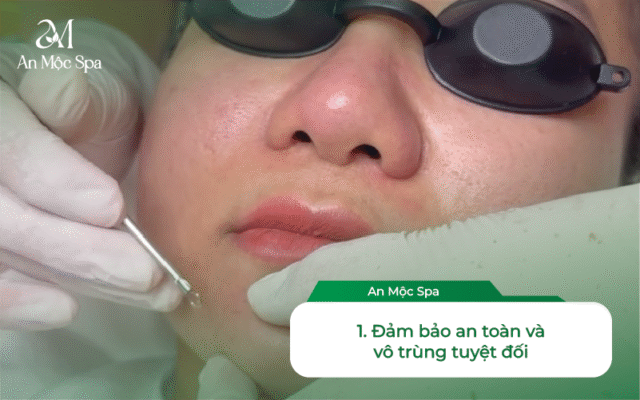Spa nặn mụn Hà Nội