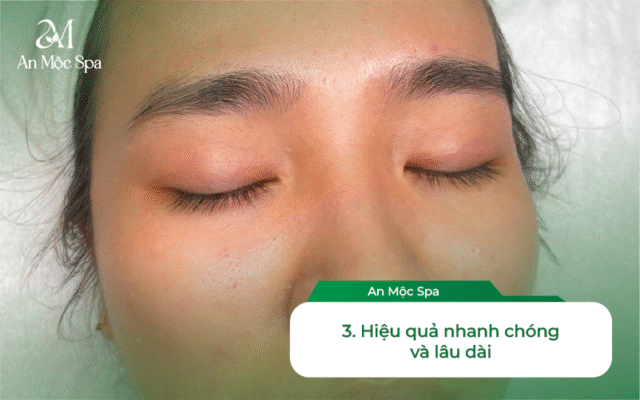 Spa nặn mụn Hà Nội