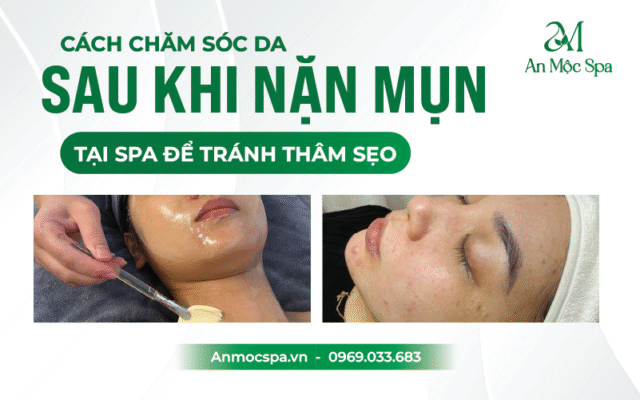 Spa nặn mụn Hà Nội