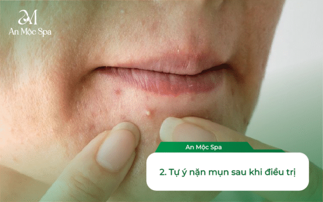 spa nặn mụn Hà Nội