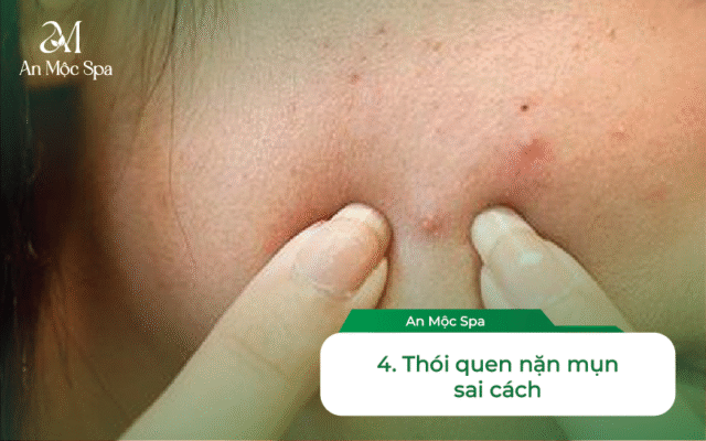 chăm sóc da mụn chuẩn y khoa