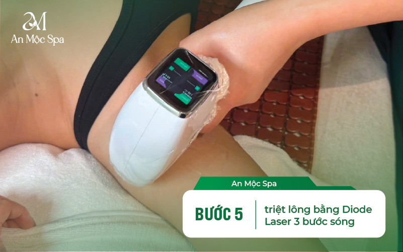 triệt lông diode laser