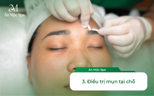 Spa nặn mụn gần đây
