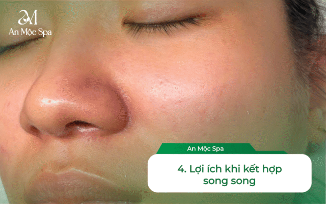 Spa nặn mụn uy tín Hà Nội