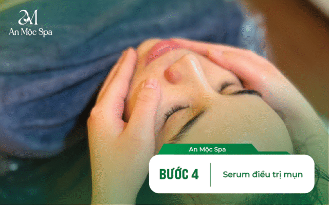 skincare cho da mụn