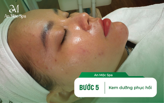 lấy nhân mụn có để lại sẹo không