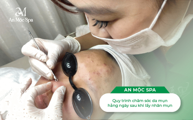 nặn-mụn-hà-nội