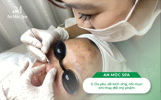 nặn-mụn-cầu-giấy