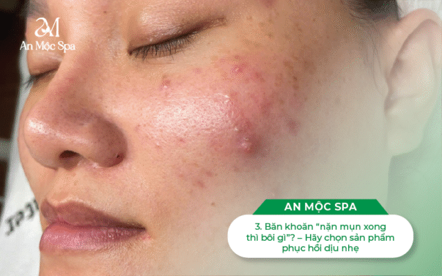 nặn-mụn-cầu-giấy