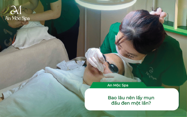 lấy nhân mụn chuyên sâu mụn đầu đen
