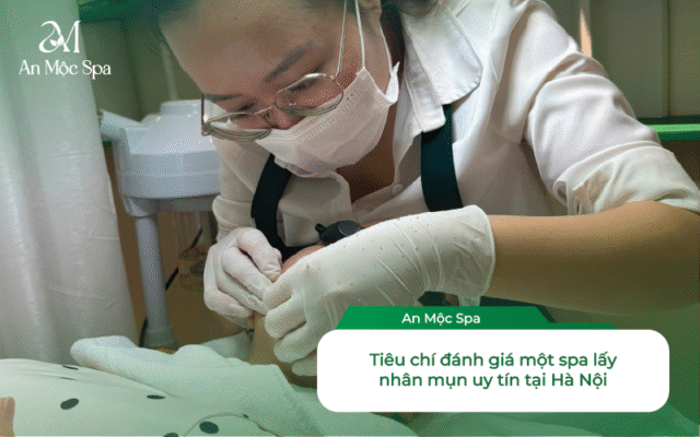 spa lấy nhân mụn uy tín tại Hà Nội