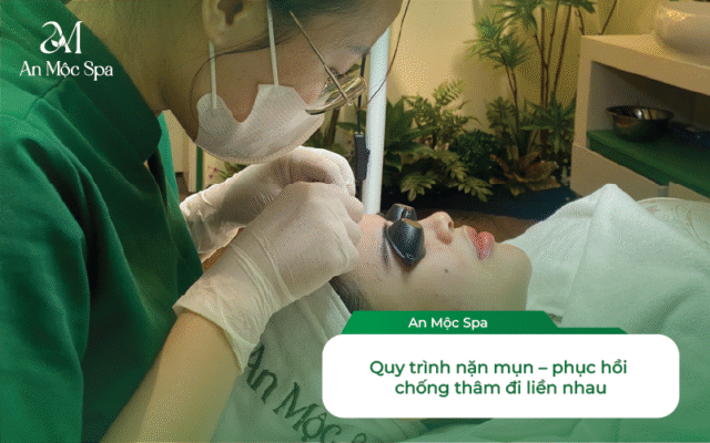 nặn mụn không để lại thâm