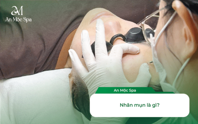 lấy nhân mụn cho dân văn phòng