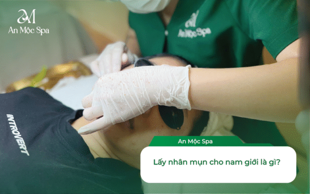 lấy nhân mụn cho nam giới
