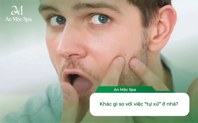 lấy nhân mụn cho nam giới