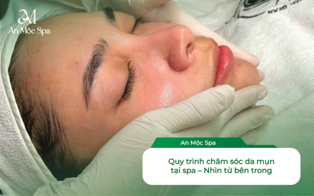 chăm sóc da mụn tại spa