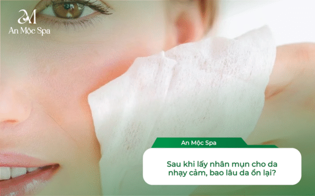 lấy nhân mụn cho da nhạy cảm