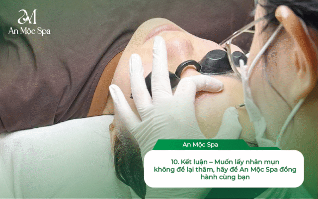 lấy nhân mụn không để lại thâm