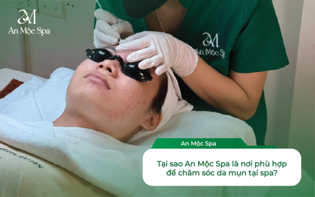 chăm sóc da mụn tại spa