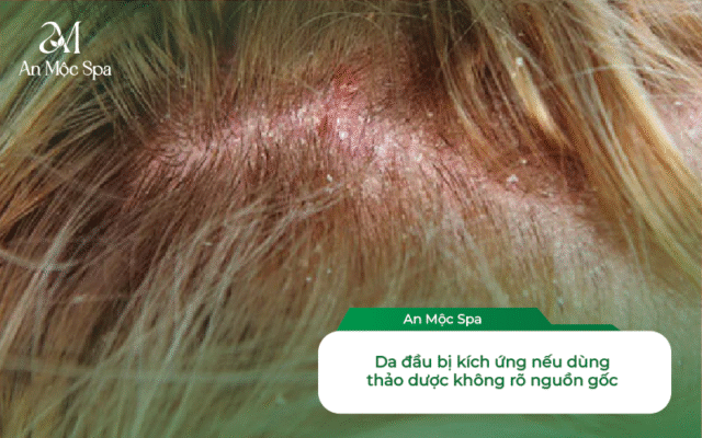 Gội đầu dưỡng sinh