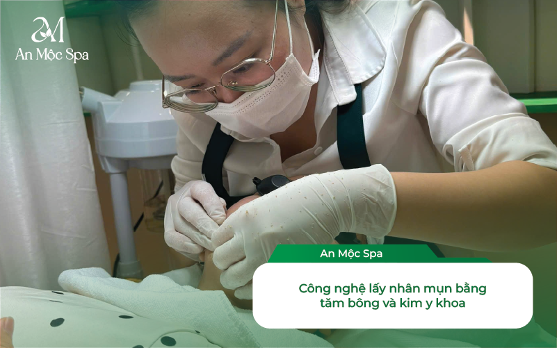 Spa Nặn Mụn Cầu Giấy