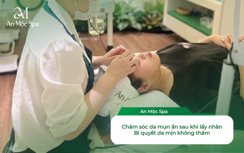 Nặn Mụn ẩn Có Nên Không