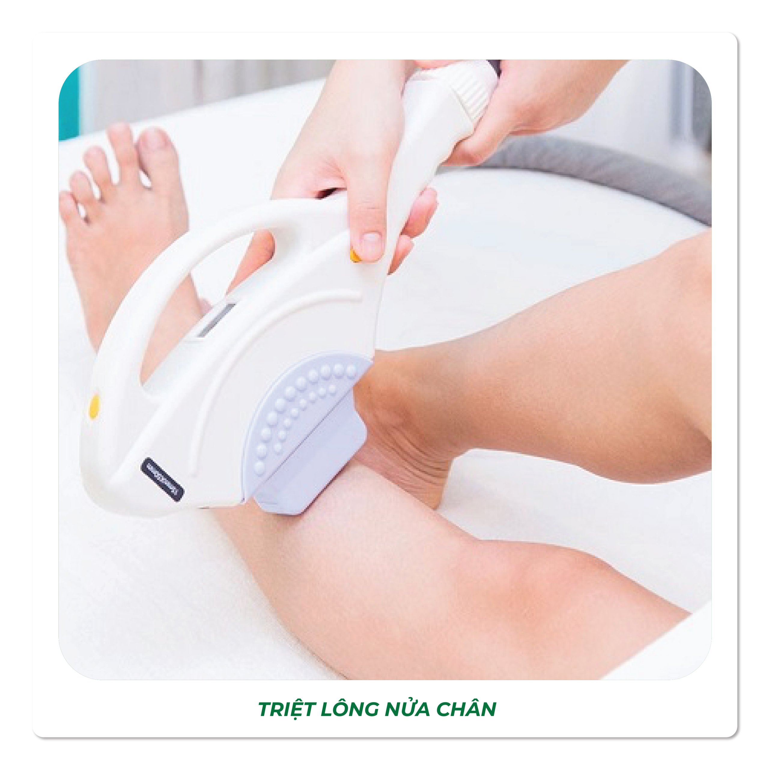 Triệt Lông Nửa Chân