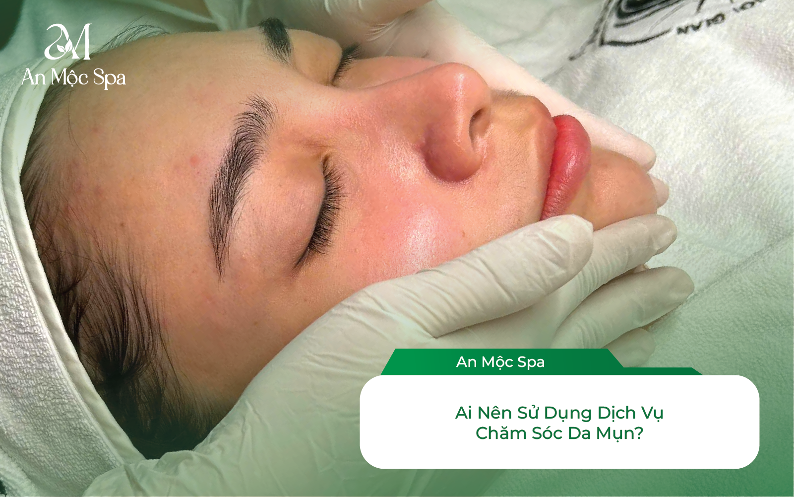 Ai nên sử dụng dịch vụ chăm sóc da mụn