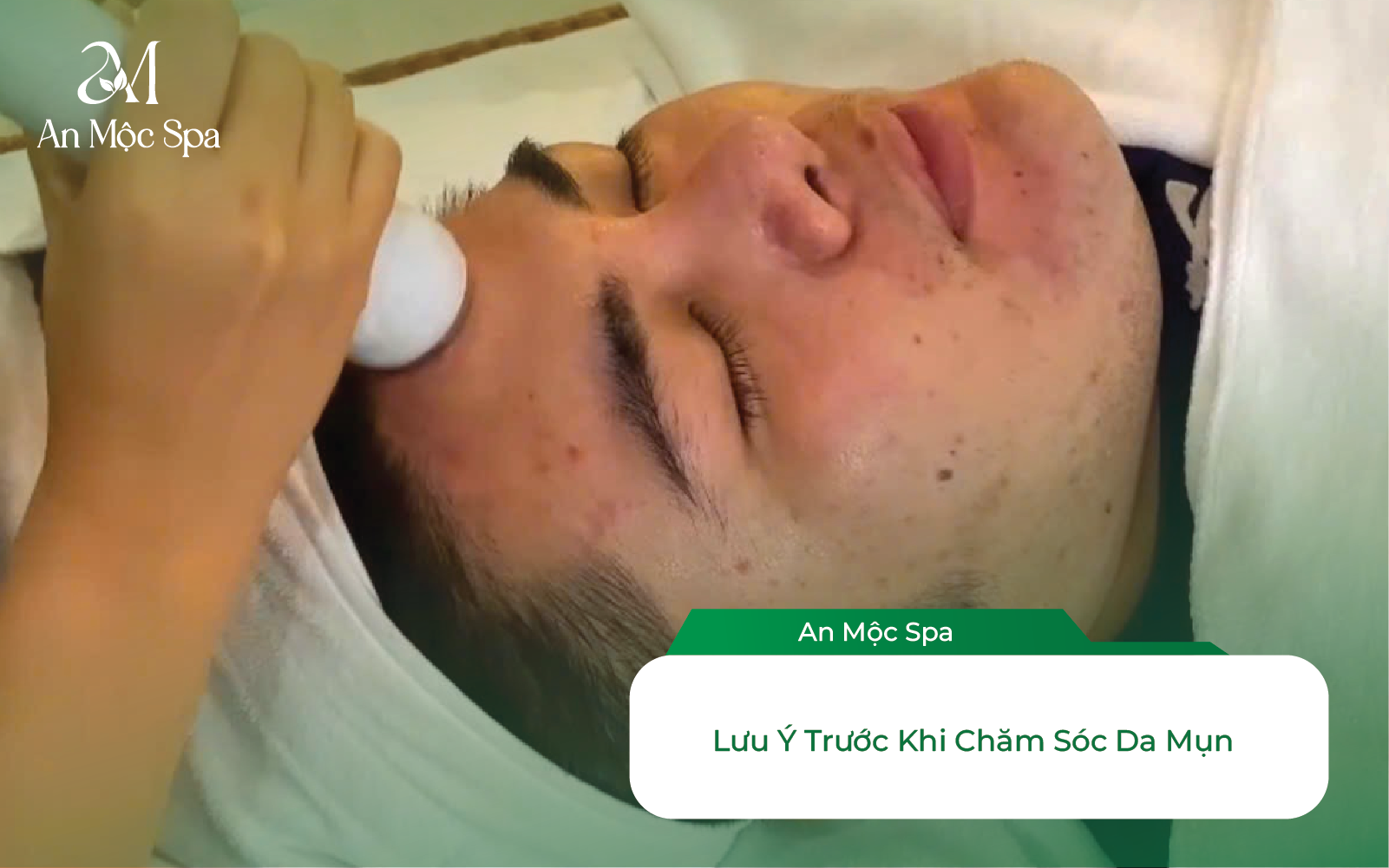 Lưu ý trước khi chăm sóc da mụn
