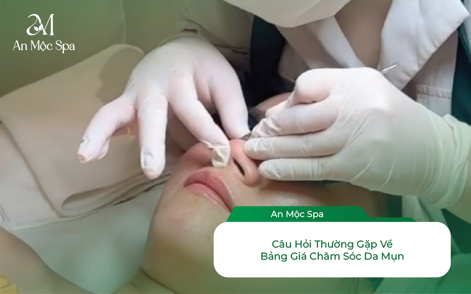 Câu hỏi thường gặp về chăm sóc da mụn
