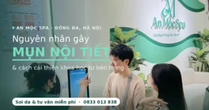 Chuyên viên An Mộc Spa soi da tư vấn tình trạng mụn nội tiết cho khách tại Đống Đa, Hà Nội
