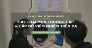 Chuyên viên An Mộc Spa soi da và tư vấn các loại mụn thường gặp cho khách tại Đống Đa, Hà Nội